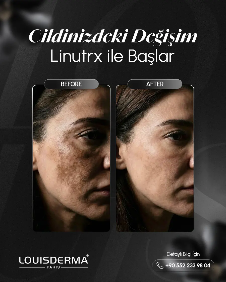 Louis Derma çalışması 9