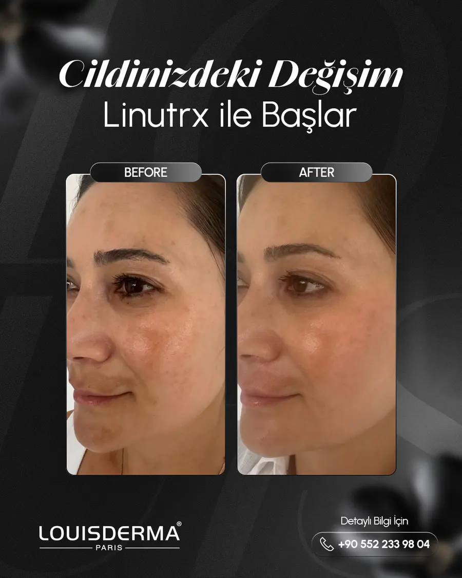 Louis Derma çalışması 10